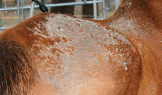 DERMATOSE BACTERIENNE , MYCOSE